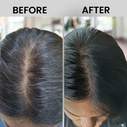 Hair Growth Result