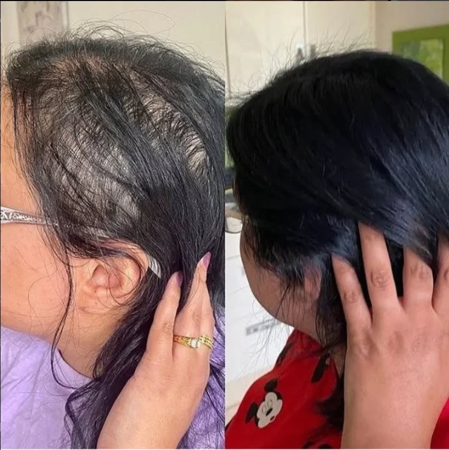 Hair Growth Result